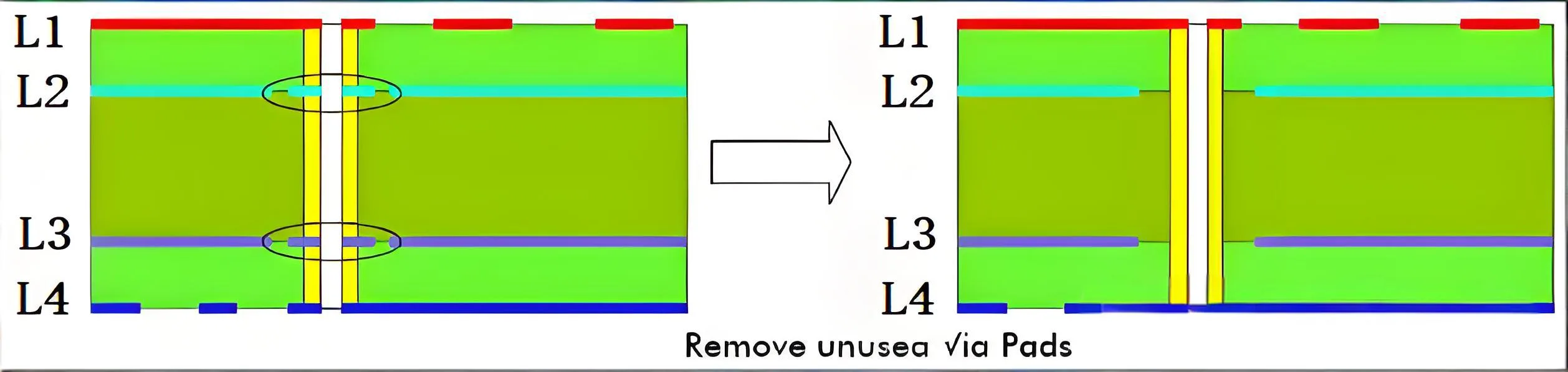 Via optimization by inner layer annular ring removal for improved signal integrity.